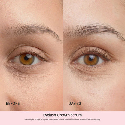 Eyelash Growth Serum - Save Up To 30% Today
