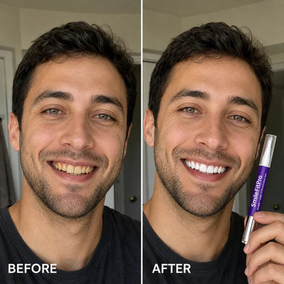 SmileFitPro PAP+ Purple Teeth Whitening Pen