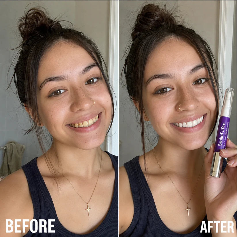 SmileFitPro PAP+ Purple Teeth Whitening Pen