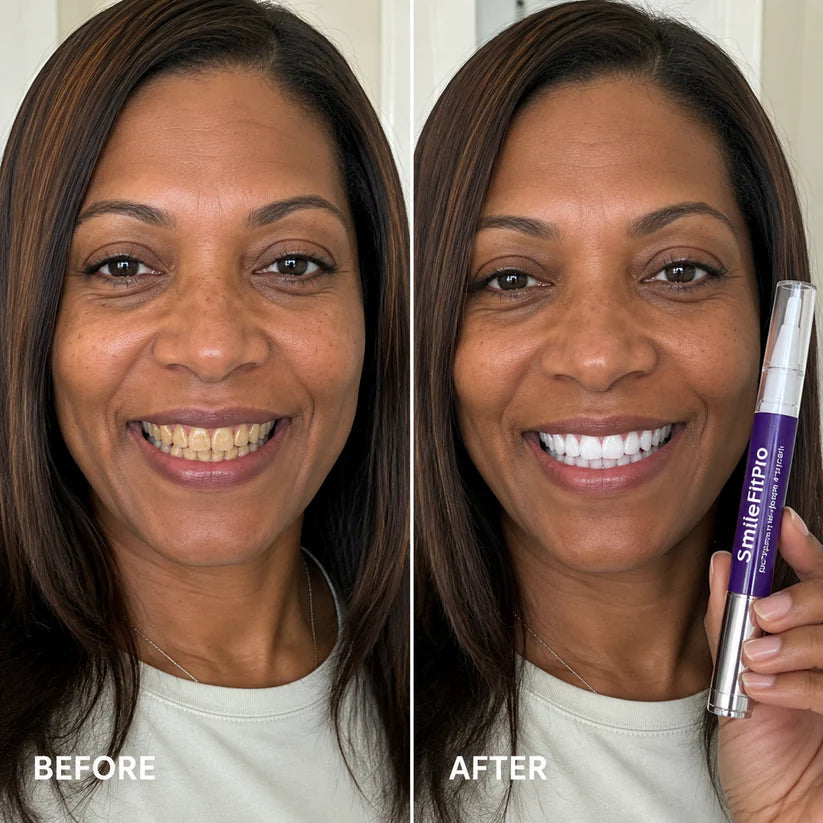 SmileFitPro PAP+ Purple Teeth Whitening Pen