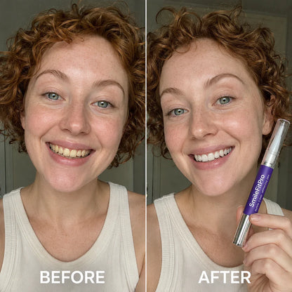 SmileFitPro PAP+ Purple Teeth Whitening Pen