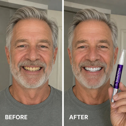 SmileFitPro PAP+ Purple Teeth Whitening Pen